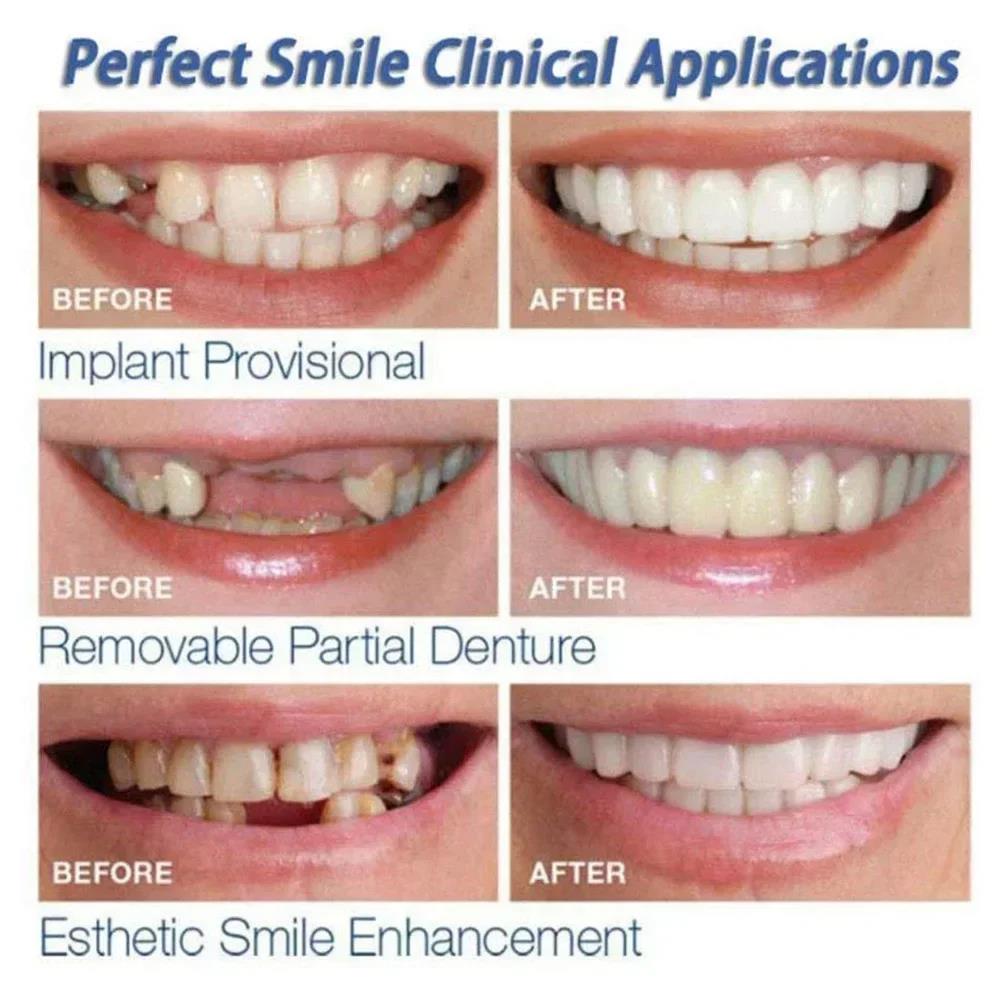 Teeth Whitening Vape - Best Sellers Teeth Kit Fake Temporary