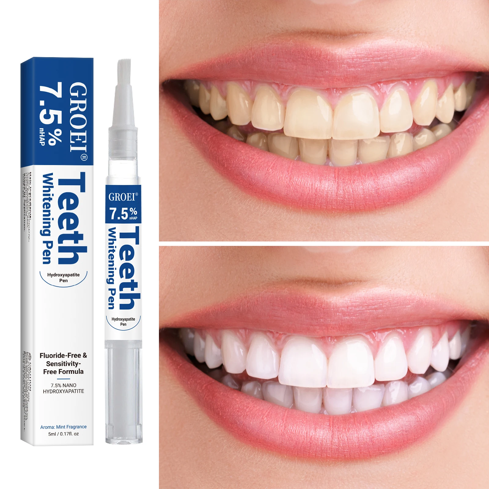Hydroxyapatite Tooth Whitening - Teeth Whitening With Peroxide บทวิจารณ์และราคา