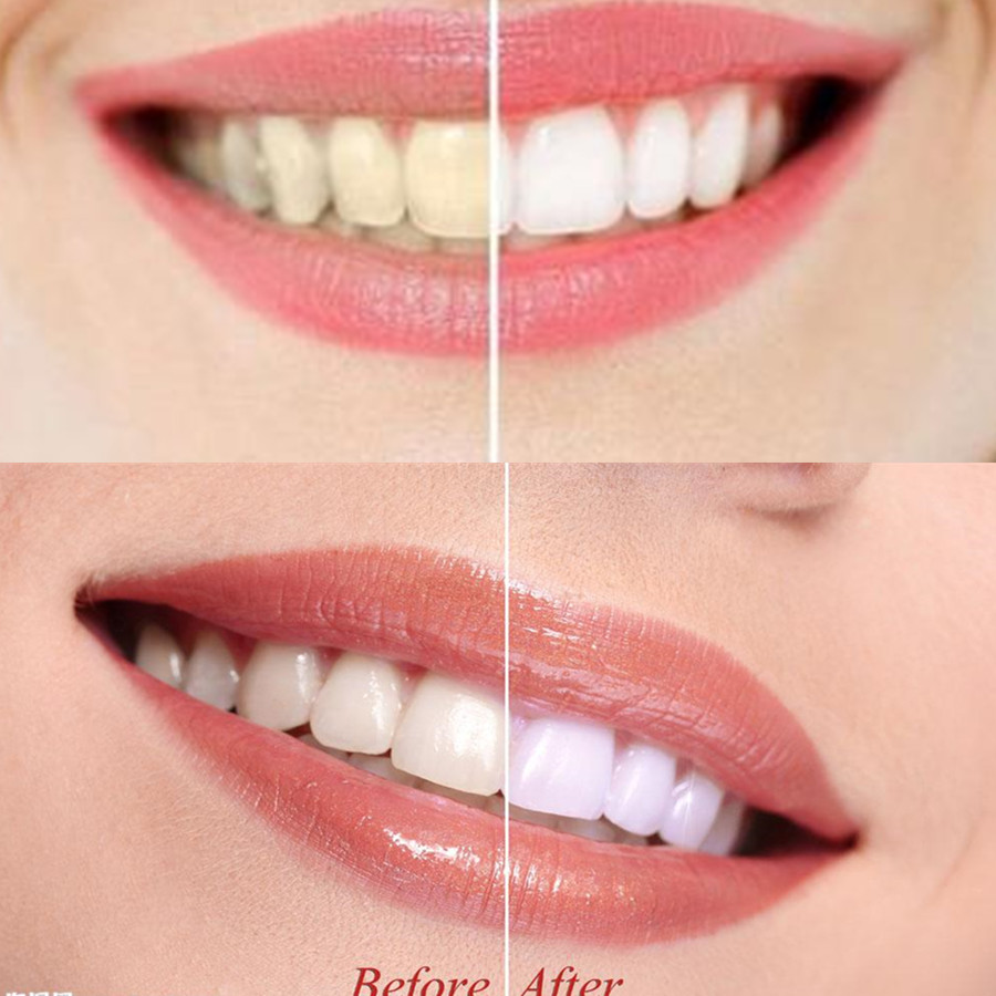 Bamboo Charcoal Teeth Tooth De - Teeth Whitening Effective บทวิจารณ์และราคา