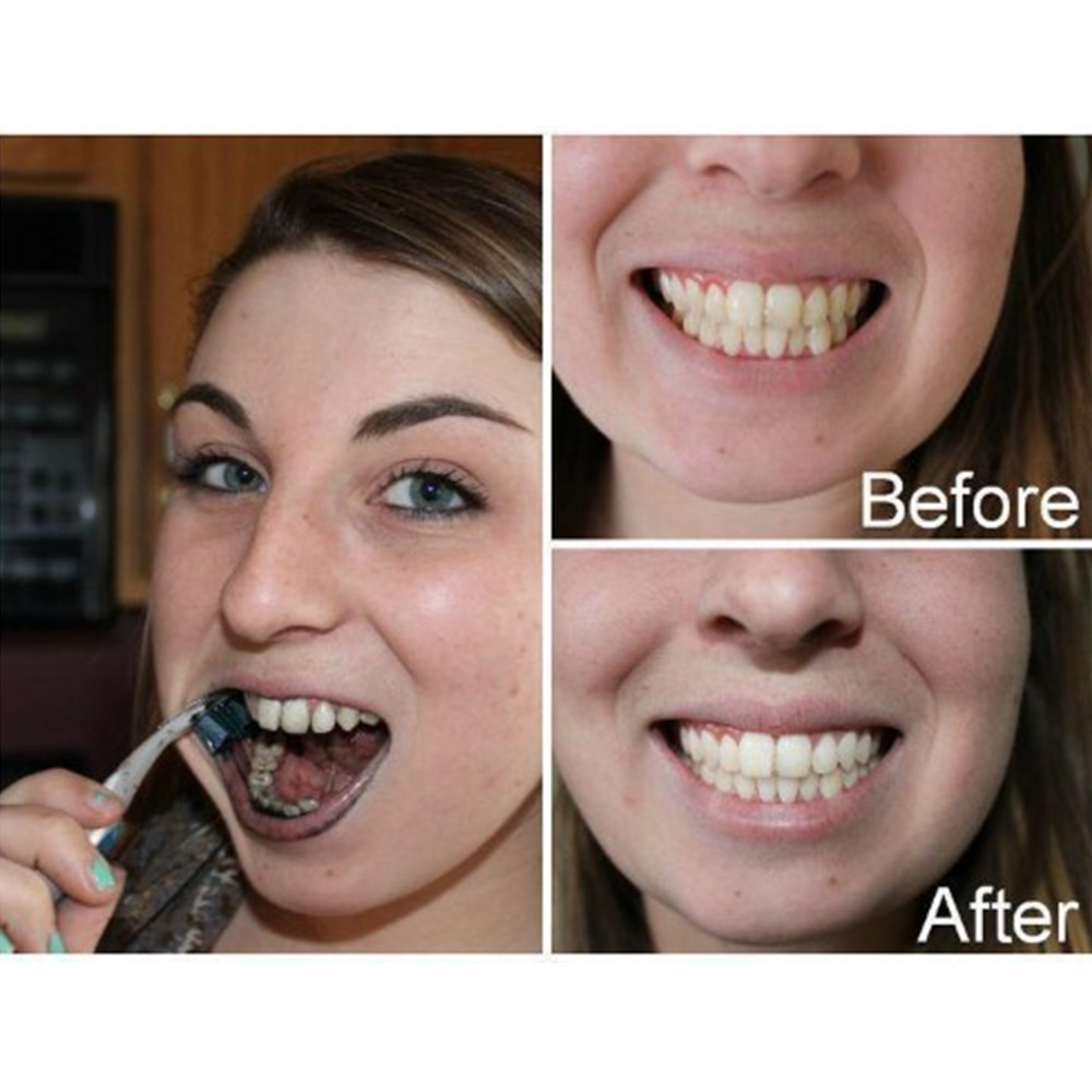 Bamboo Charcoal Teeth Tooth De - Teeth Whitening Effective บทวิจารณ์และราคา