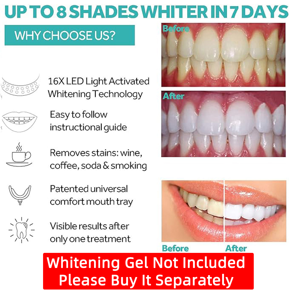 Vaclav Teeth Whitening Light K - Teeth Whitening Uv Kit บทวิจารณ์และราคา