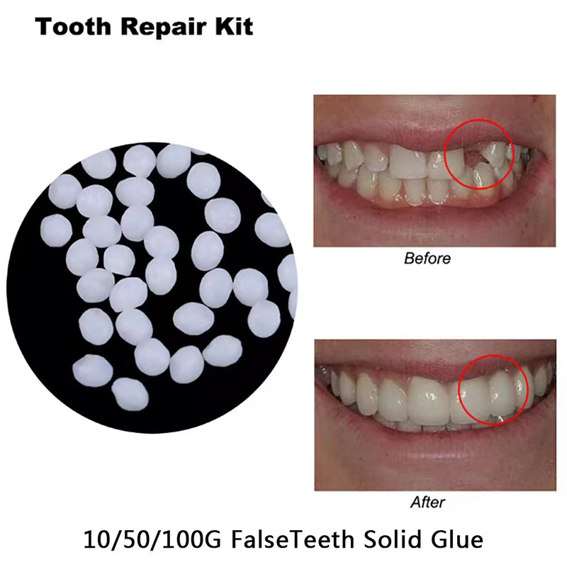 10g/bag Tooth Repair Kit-therm - Teeth Whitening Uv Kit บทวิจารณ์และราคา