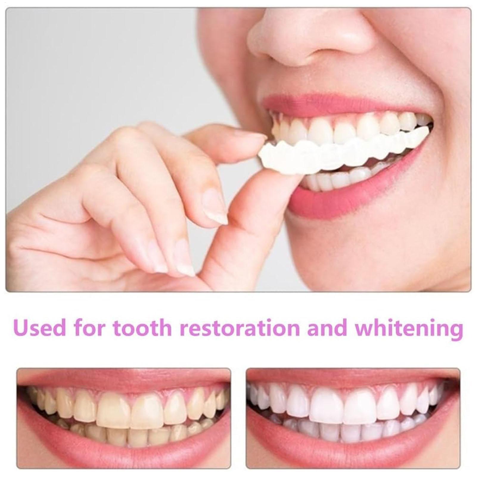 Oralhoe Dental Care Kit Produc - Teeth Whitening Uv Kit บทวิจารณ์และราคา