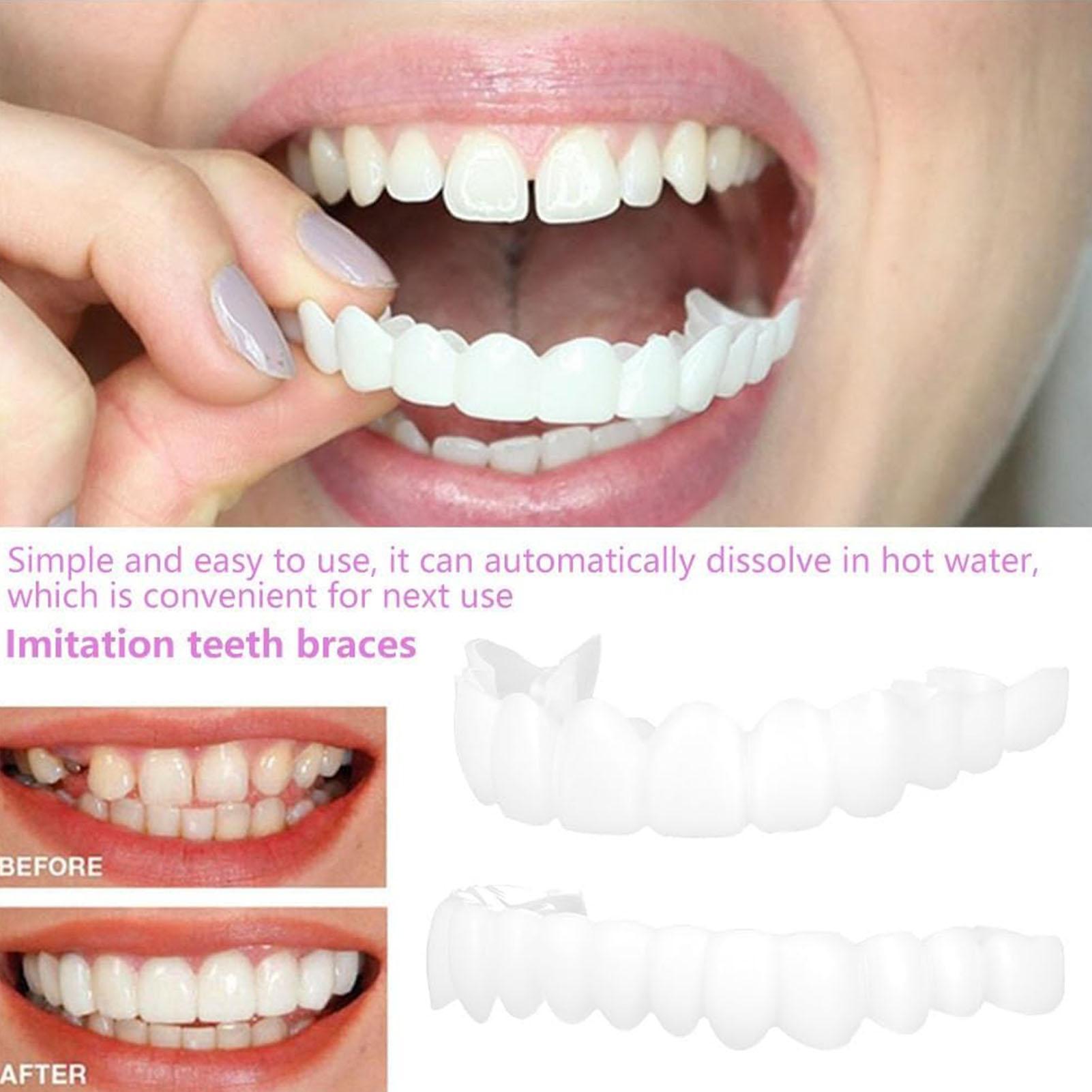 Oralhoe Dental Care Kit Produc - Teeth Whitening Uv Kit บทวิจารณ์และราคา