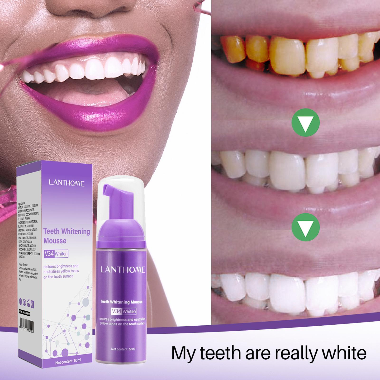 V34 Mousse Teeth Cleaning Toot - Teeth Whitening Effective บทวิจารณ์และราคา