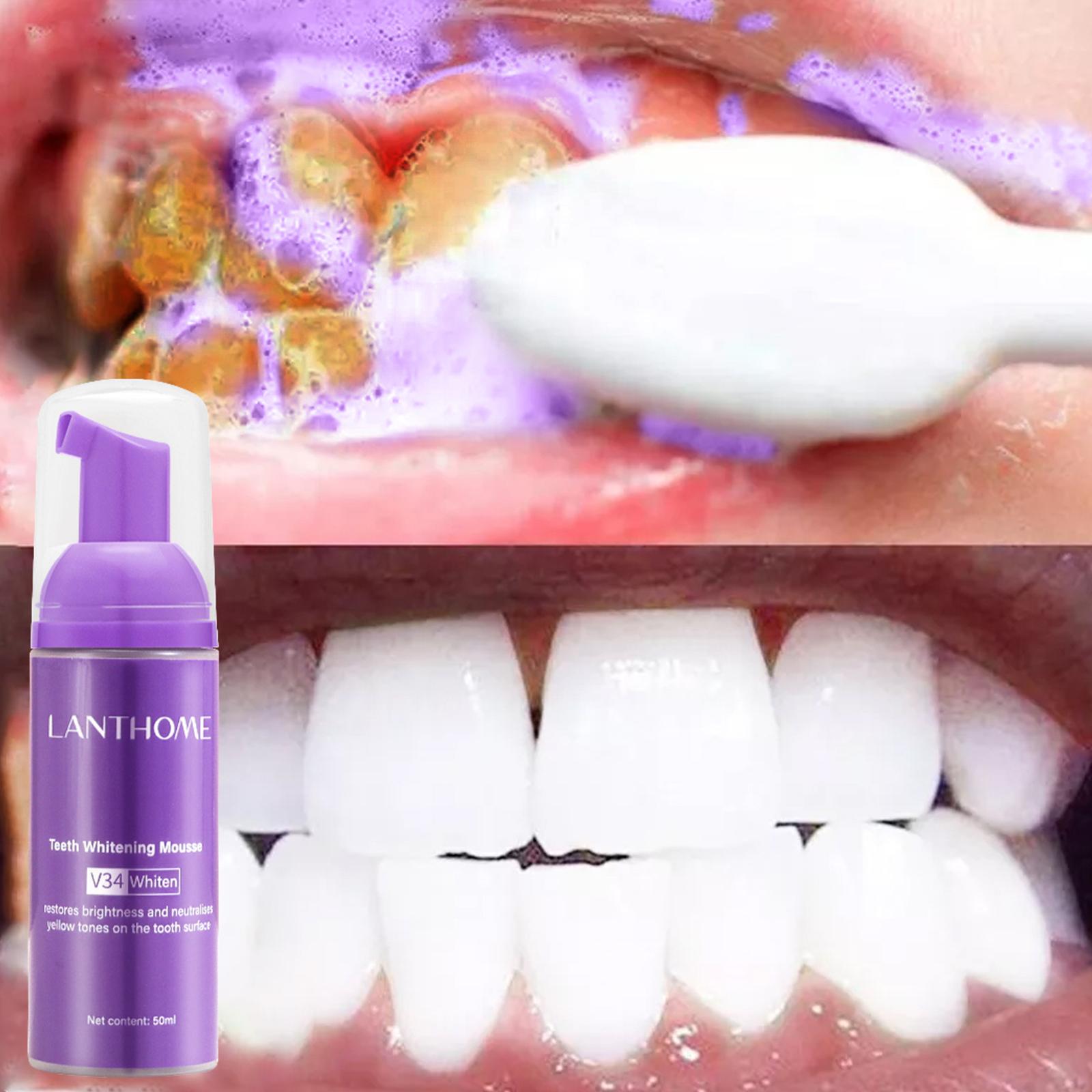 V34 Mousse Teeth Cleaning Toot - Teeth Whitening Effective บทวิจารณ์และราคา