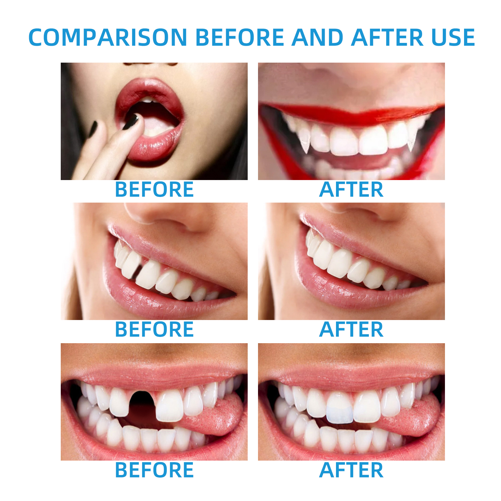 DIY Temporary Tooth Repair Kit - Teeth Whitening Uv Kit บทวิจารณ์และราคา