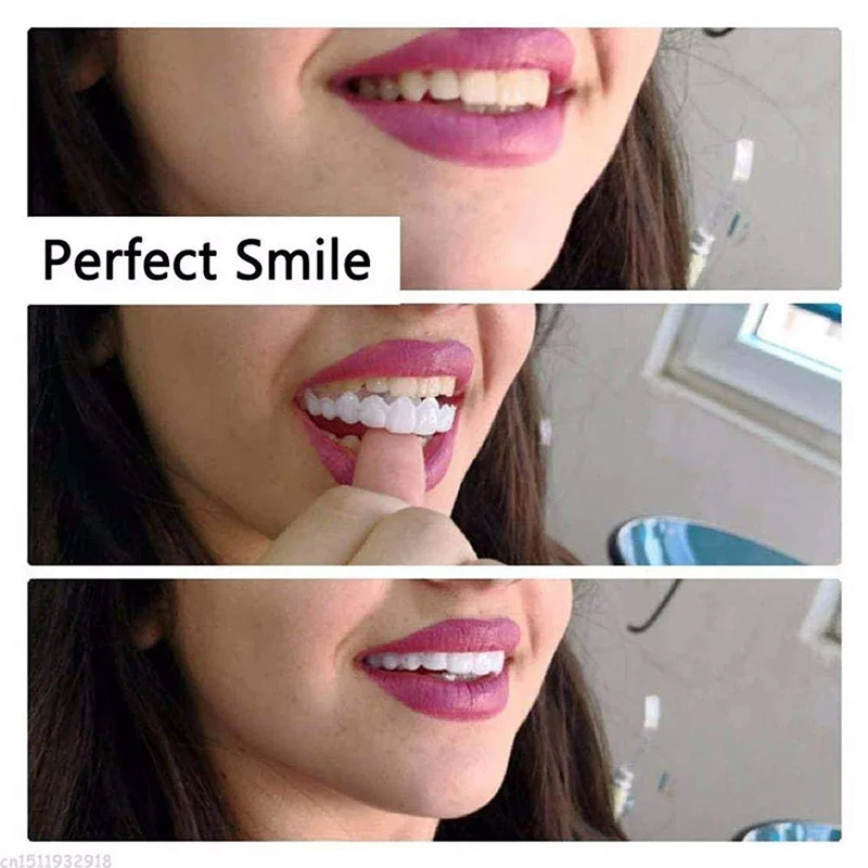 Veneer Snap-on Teeth Kit Fake  - Teeth Whitening Vape บทวิจารณ์และราคา