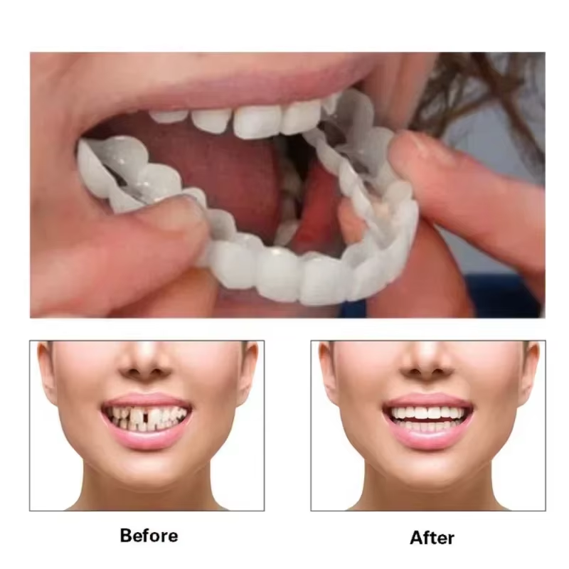 Veneer Snap-on Teeth Kit Fake  - Teeth Whitening Vape บทวิจารณ์และราคา