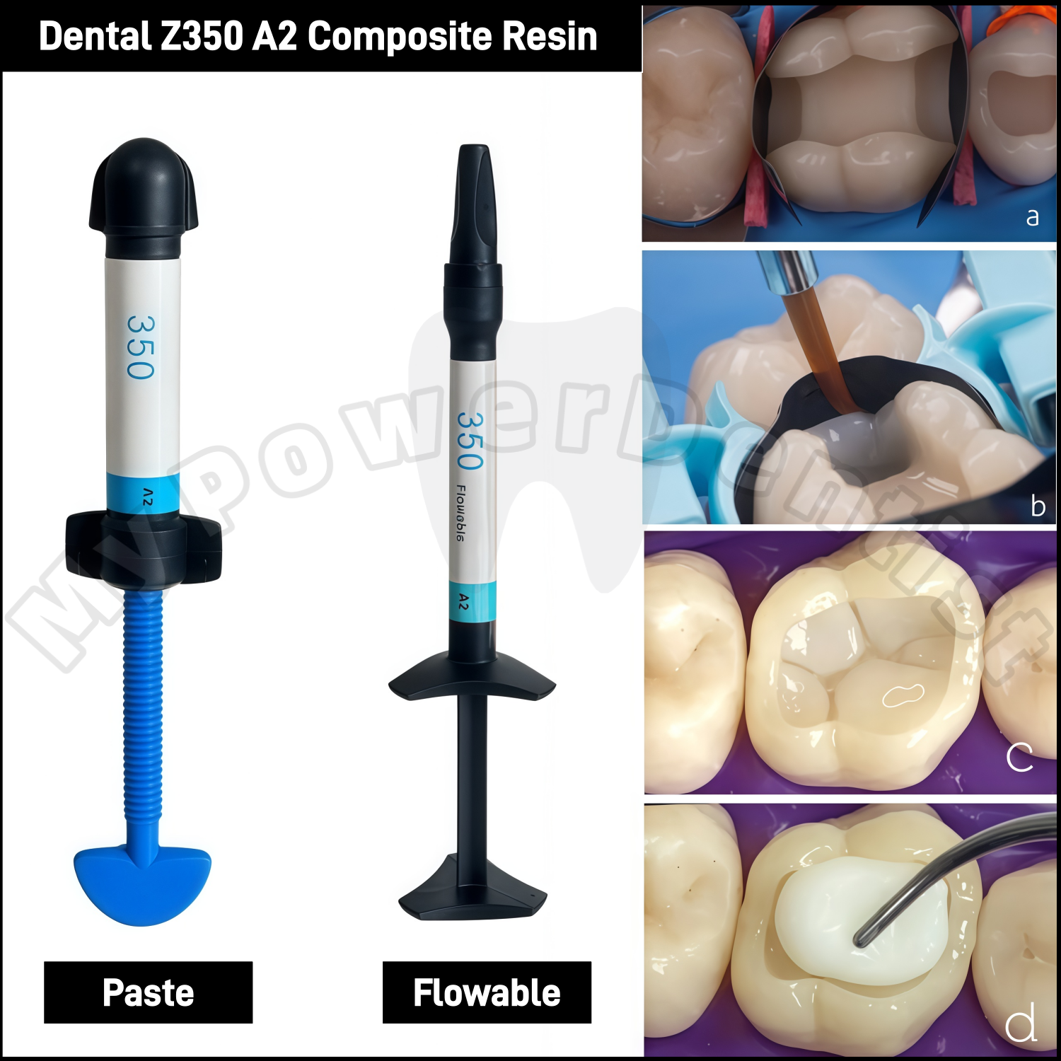 Z350 A2  Dental Composite Resi - Teeth Whitening Veneers บทวิจารณ์และราคา