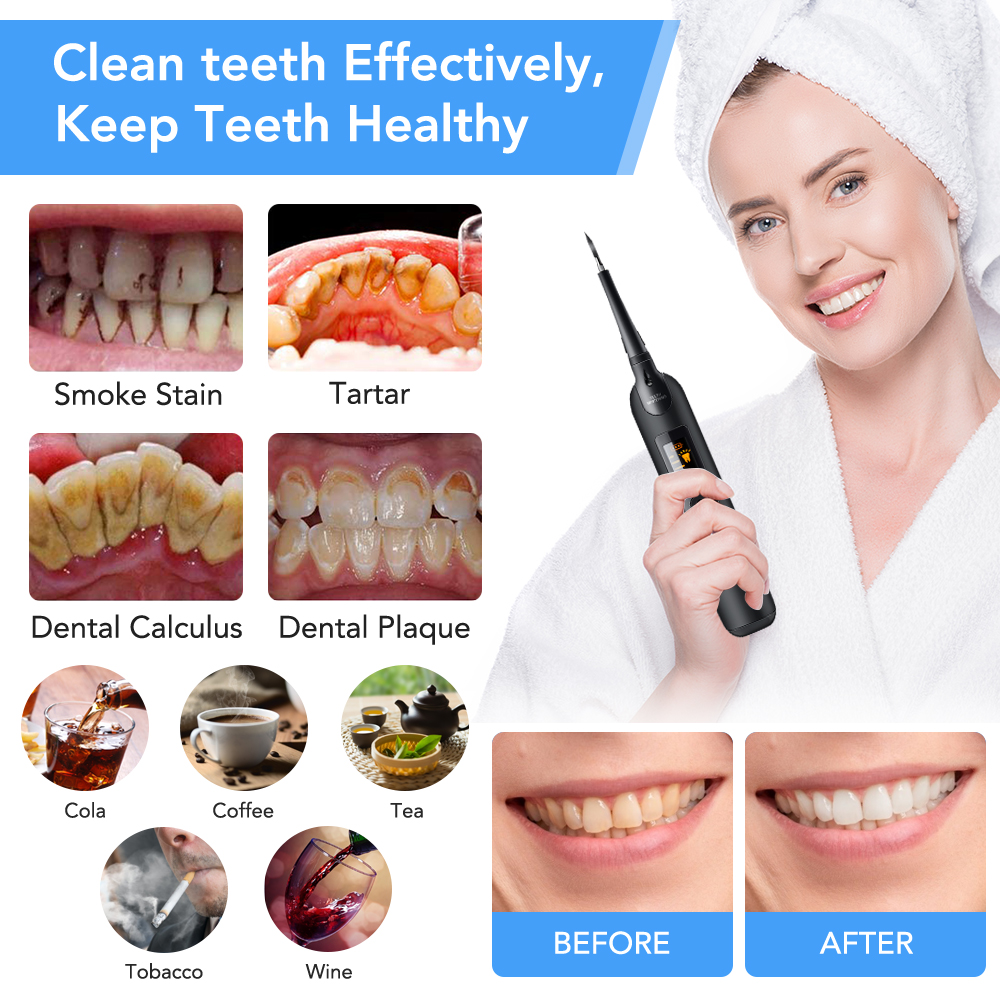 Teeth Tartar Remover Electric  - Teeth Whitening Vape บทวิจารณ์และราคา
