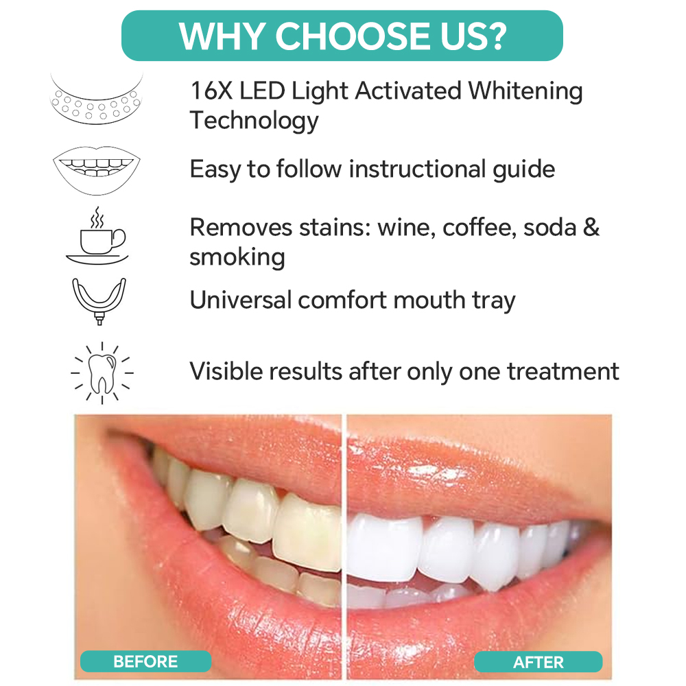 Teeth Whitening Accelerator Li - Teeth Whitening Accelerator บทวิจารณ์และราคา