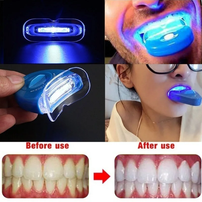 Home Mini Convenient Led Blue  - Teeth Whitening Uv Kit บทวิจารณ์และราคา