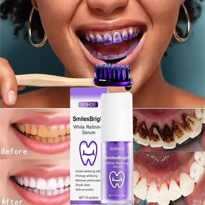Teeth Cleansing Whitening Toot - Teeth Whitening Korea บทวิจารณ์และราคา