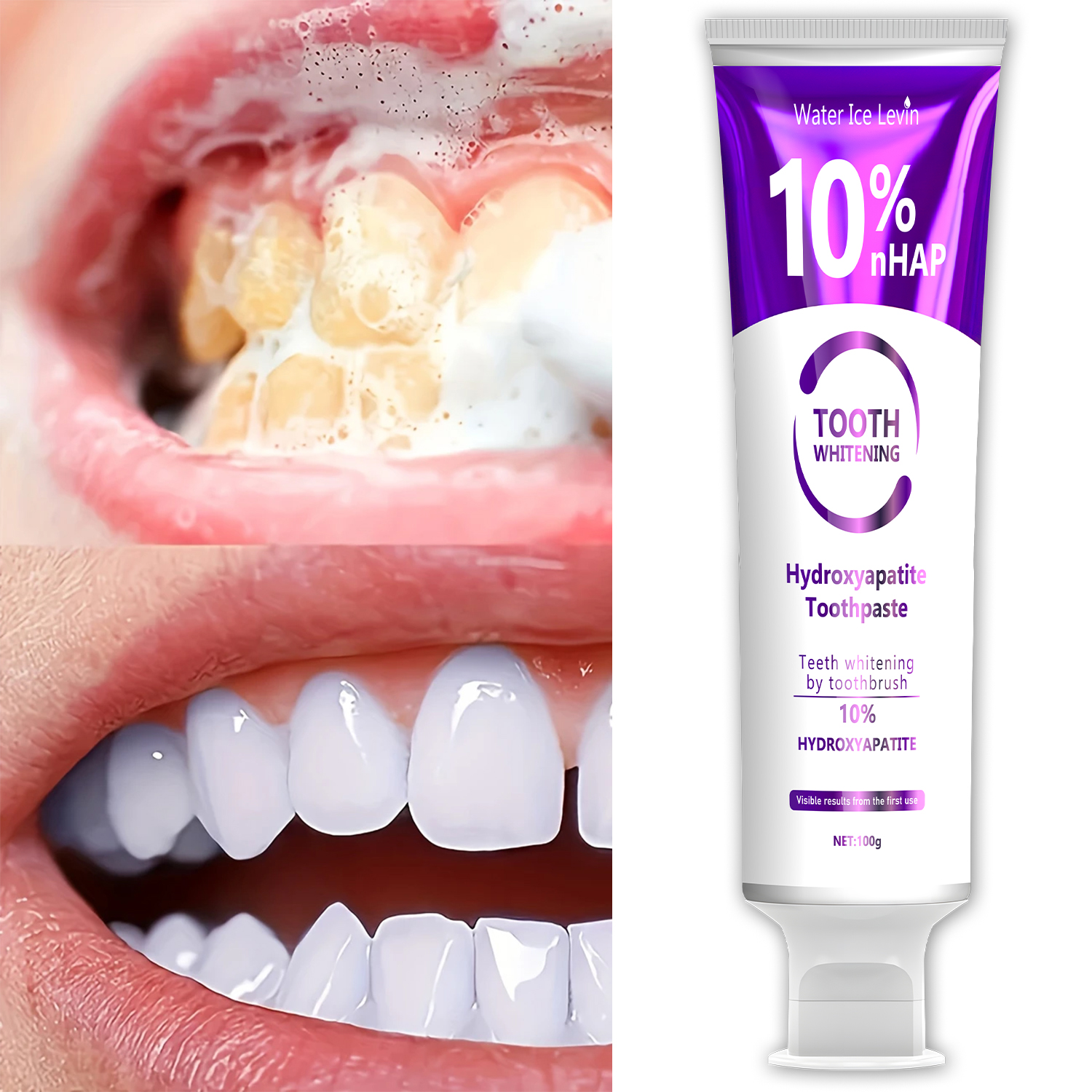10% Nanoh Hydrogen Oxide Tooth - Teeth Whitening With Peroxide บทวิจารณ์และราคา