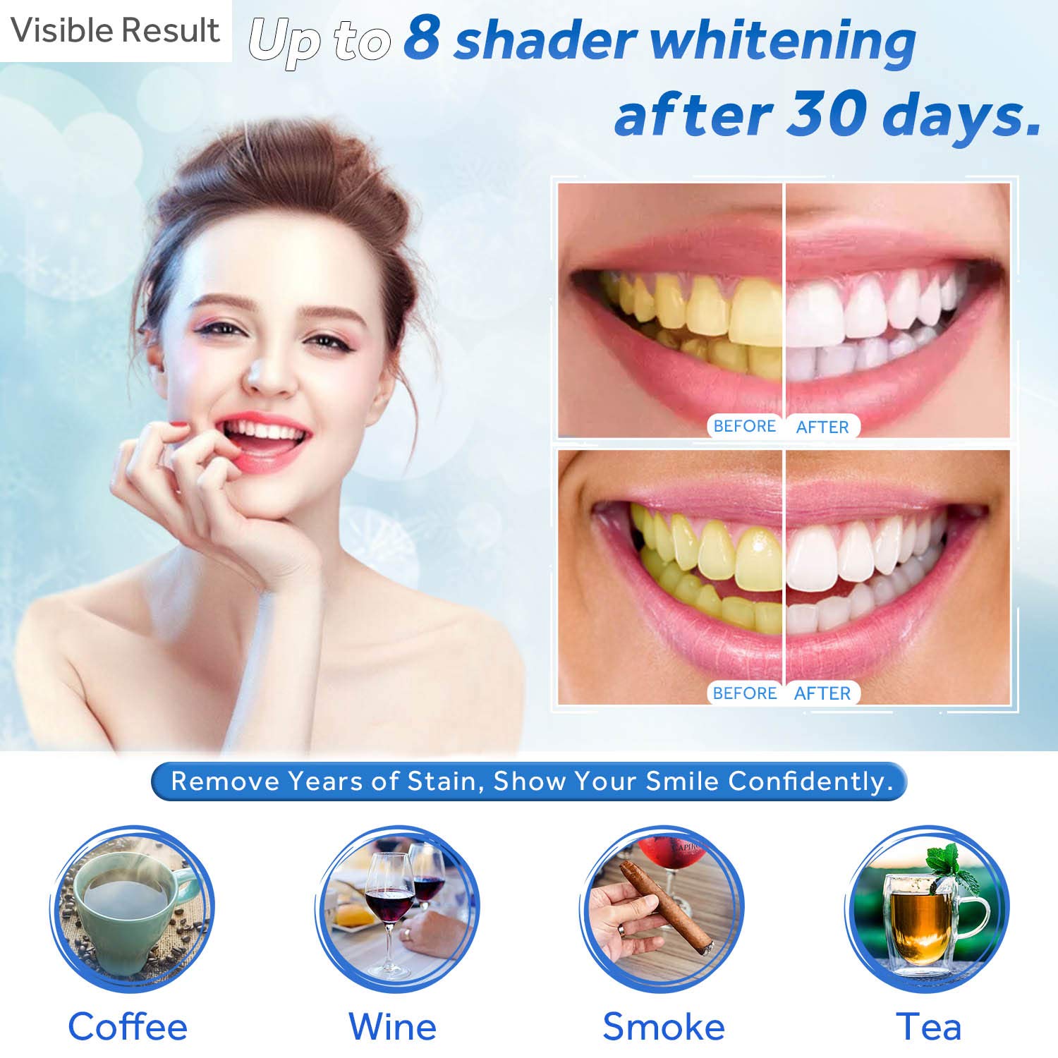 Teeth Whitening Gel Refill Syr - Teeth Whitening With Peroxide บทวิจารณ์และราคา