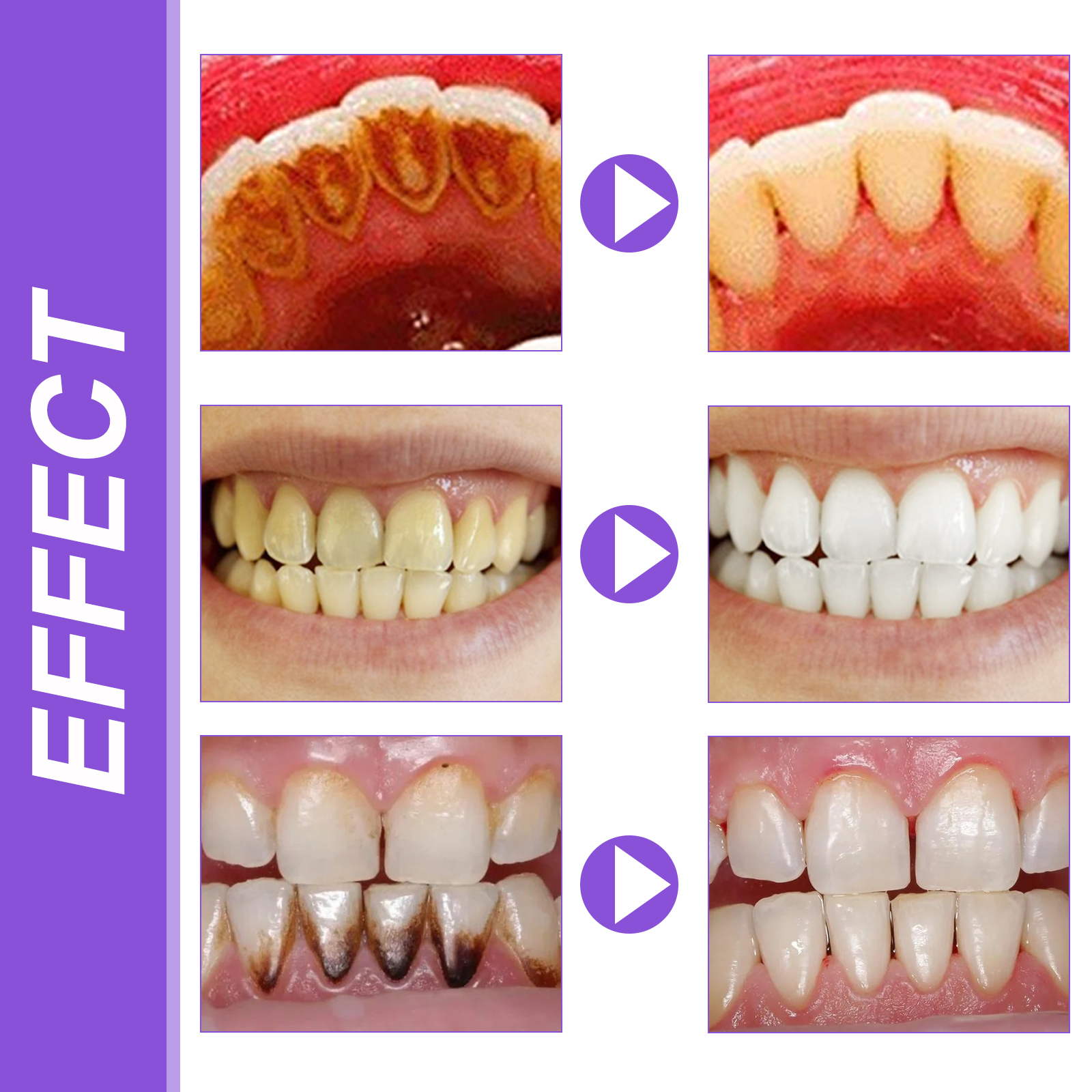 EELHOE Smiles Bright White Ref - Hydroxyapatite Toothpaste บทวิจารณ์และราคา