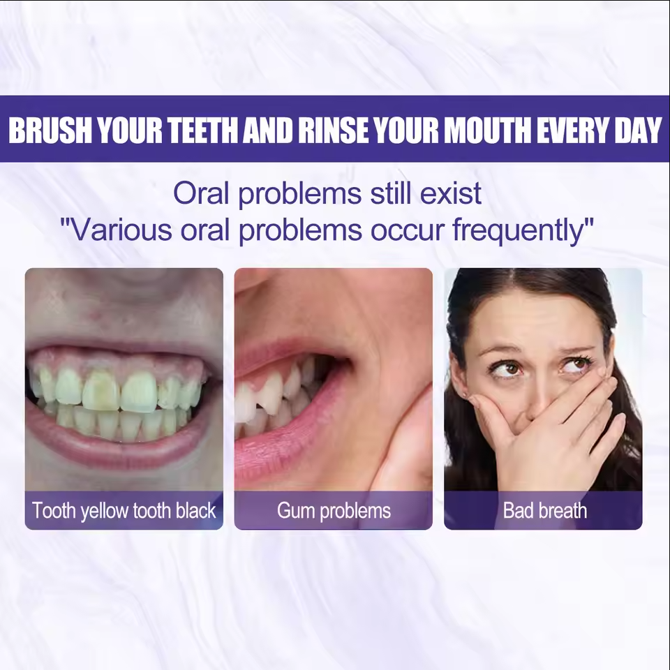 Teeth Cleansing Whitening Toot - Teeth Whitening Korea บทวิจารณ์และราคา