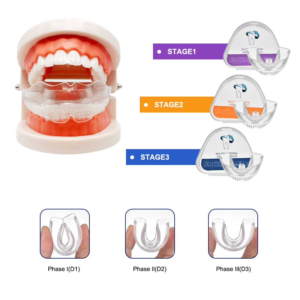 3 Stages Dental Braces Teeth T - Teeth Whitening Uv Kit บทวิจารณ์และราคา