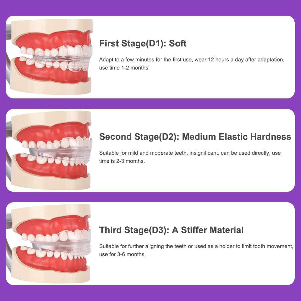 3 Stages Dental Braces Teeth T - Teeth Whitening Uv Kit บทวิจารณ์และราคา