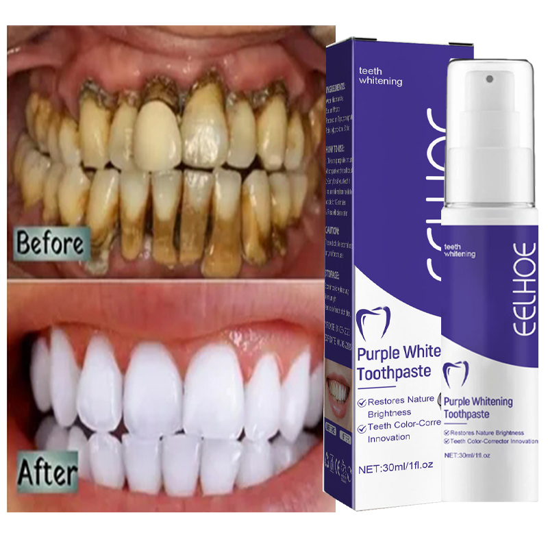 1pcs Teeth Cleansing Whitening - Teeth Whitening Korea บทวิจารณ์และราคา