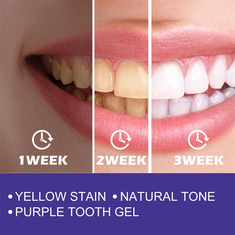 1pcs Teeth Cleansing Whitening - Teeth Whitening Korea บทวิจารณ์และราคา