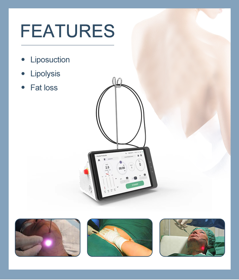 Dental Laser Teeth Whitening D - Teeth Whitening With Laser บทวิจารณ์และราคา