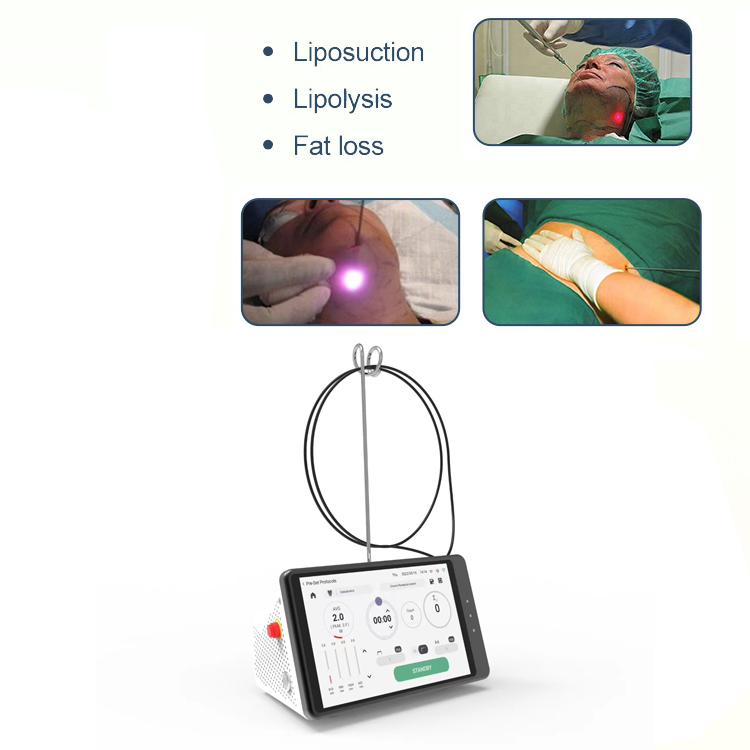 Dental Laser Teeth Whitening D - Teeth Whitening With Laser บทวิจารณ์และราคา