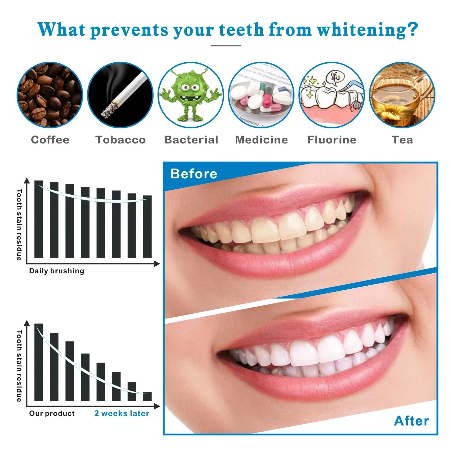 14/28pcs 3D Teeth Whitening St - Whitening Strip 3D บทวิจารณ์และราคา