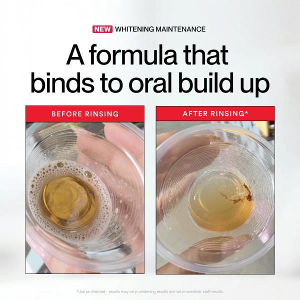 Hismile ID Whitening Stain Mou - Teeth Whitening With Peroxide บทวิจารณ์และราคา