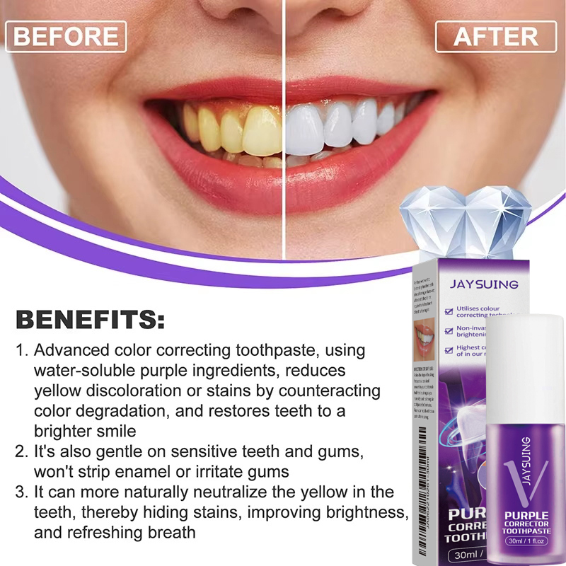 Teeth Cleansing Whitening Toot - Teeth Whitening Korea บทวิจารณ์และราคา