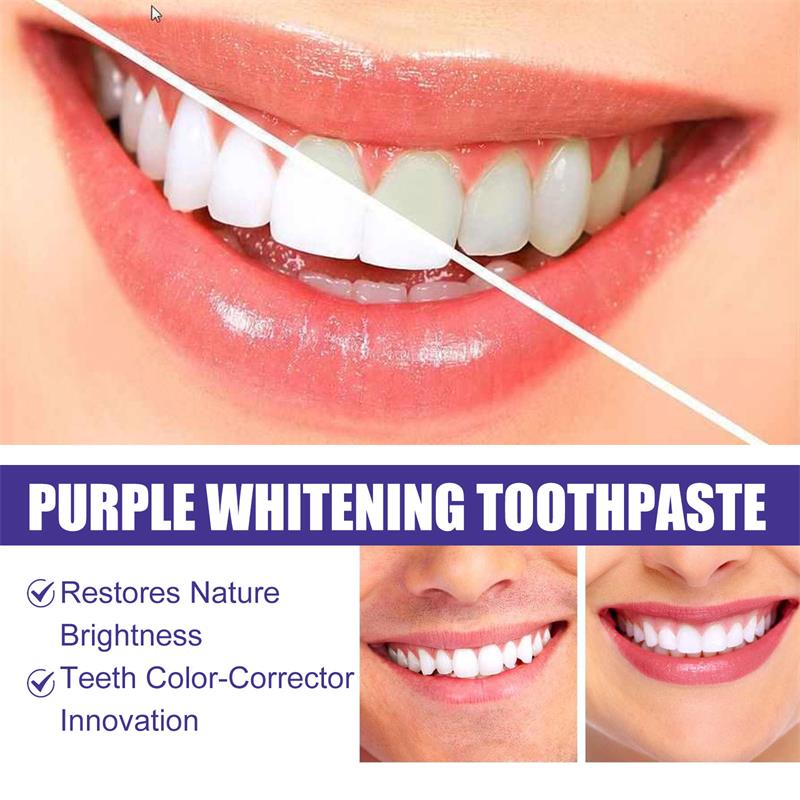 Teeth Cleansing Whitening Toot - Teeth Whitening Korea บทวิจารณ์และราคา