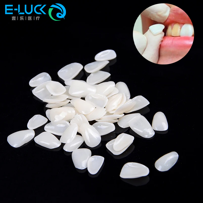 50pcs Dental Teeth Veneers Tem - Teeth Whitening Veneers บทวิจารณ์และราคา