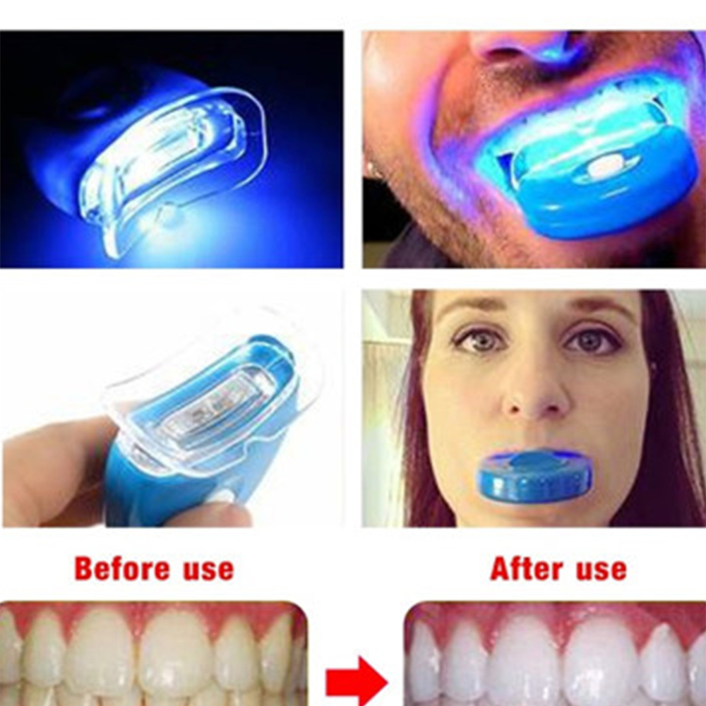 New Blue Led Teeth Whitening A - Teeth Whitening With Laser บทวิจารณ์และราคา