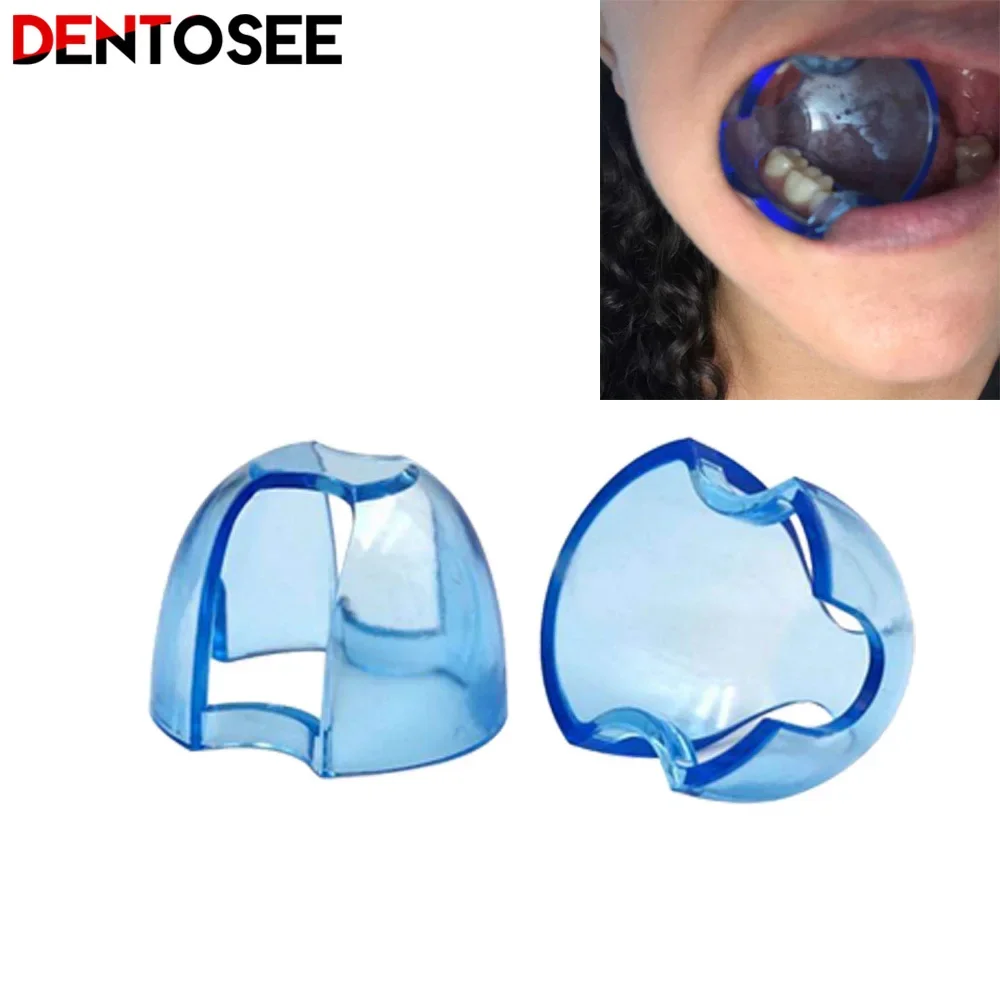 Dental Intraoral Cheek Retract - Teeth Whitening Accelerator บทวิจารณ์และราคา
