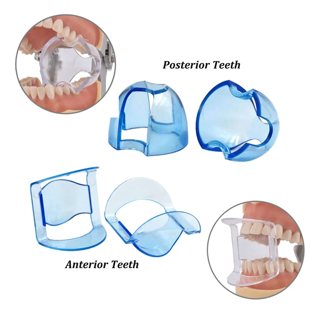 Dental Intraoral Cheek Retract - Teeth Whitening Accelerator บทวิจารณ์และราคา