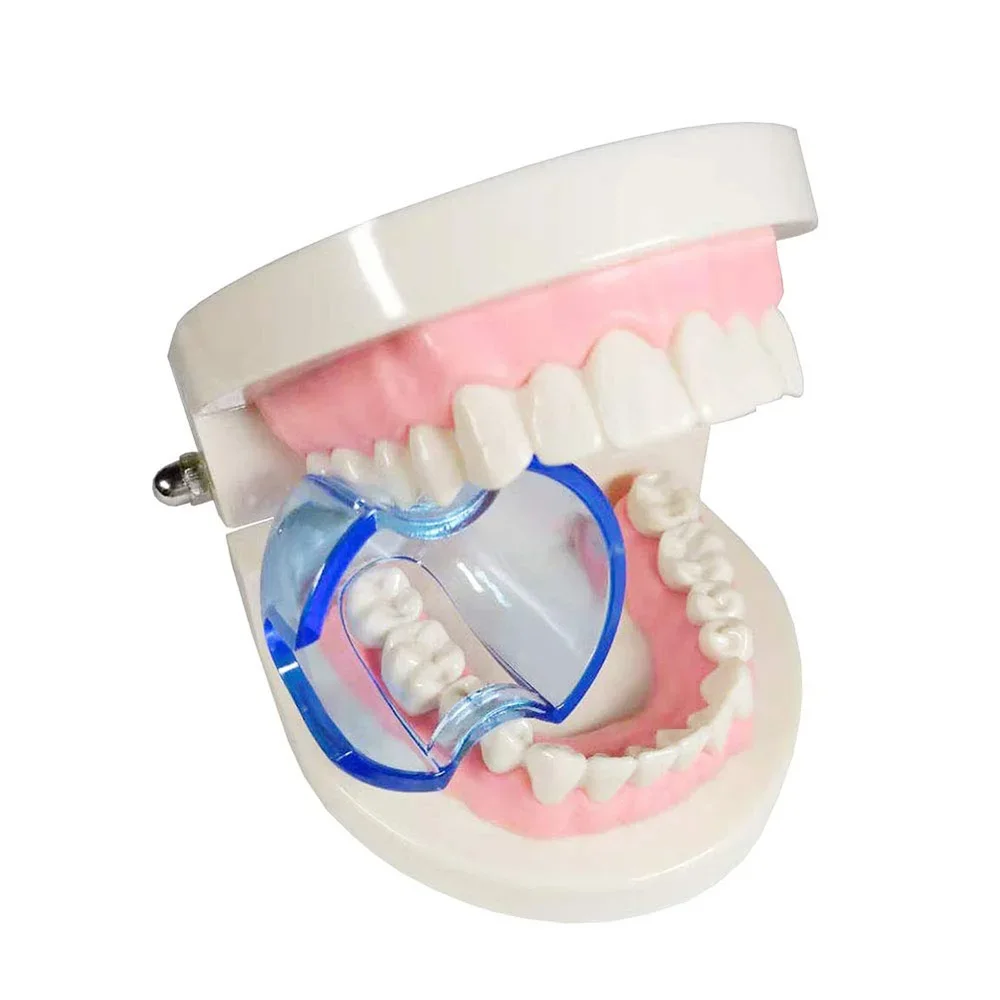 Dental Intraoral Cheek Retract - Teeth Whitening Accelerator บทวิจารณ์และราคา