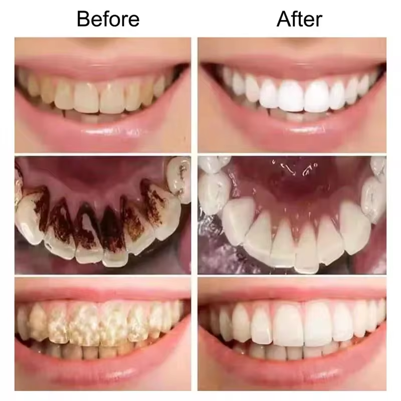 7.5% Hydroxyapatite Probiotic  - Hydroxyapatite Toothpaste บทวิจารณ์และราคา
