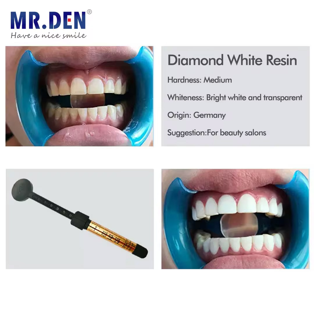 Nano enamel veneer material te - Teeth Whitening Veneers บทวิจารณ์และราคา