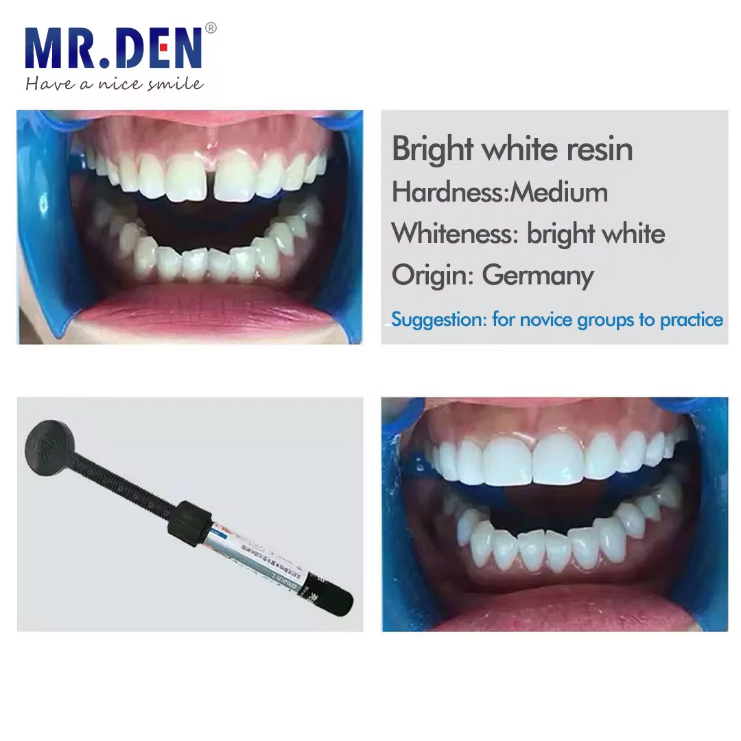 Nano enamel veneer material te - Teeth Whitening Veneers บทวิจารณ์และราคา