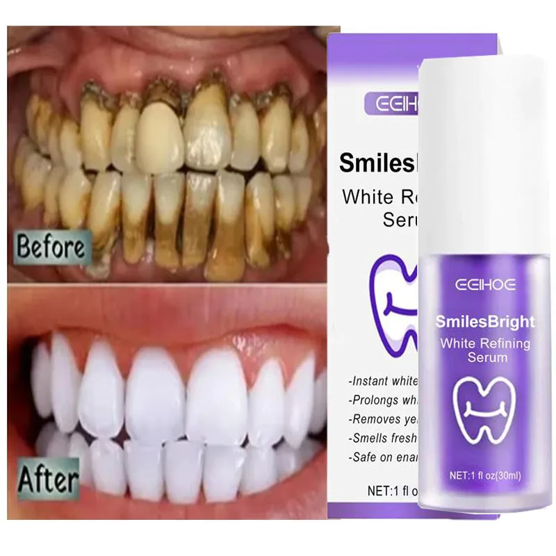 Whitening Toothpaste Teeth Cle - Teeth Whitening Korea บทวิจารณ์และราคา