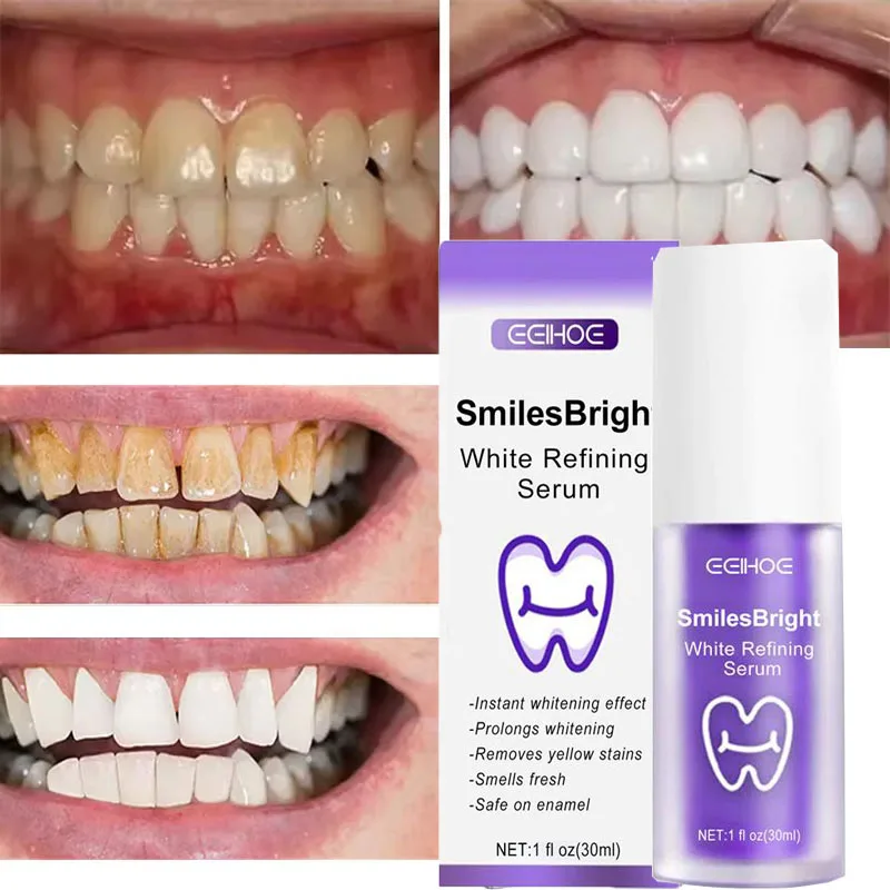 Whitening Toothpaste Teeth Cle - Teeth Whitening Korea บทวิจารณ์และราคา