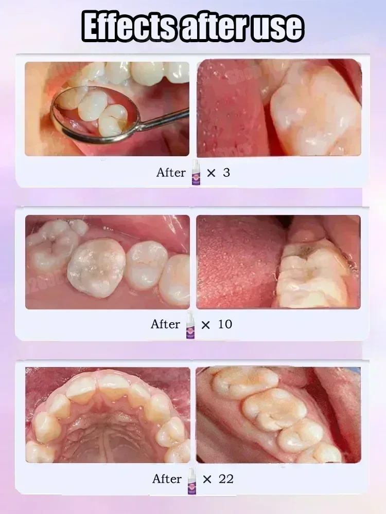 Teeth Cleaning Toothpaste Remo - Teeth Whitening Effective บทวิจารณ์และราคา