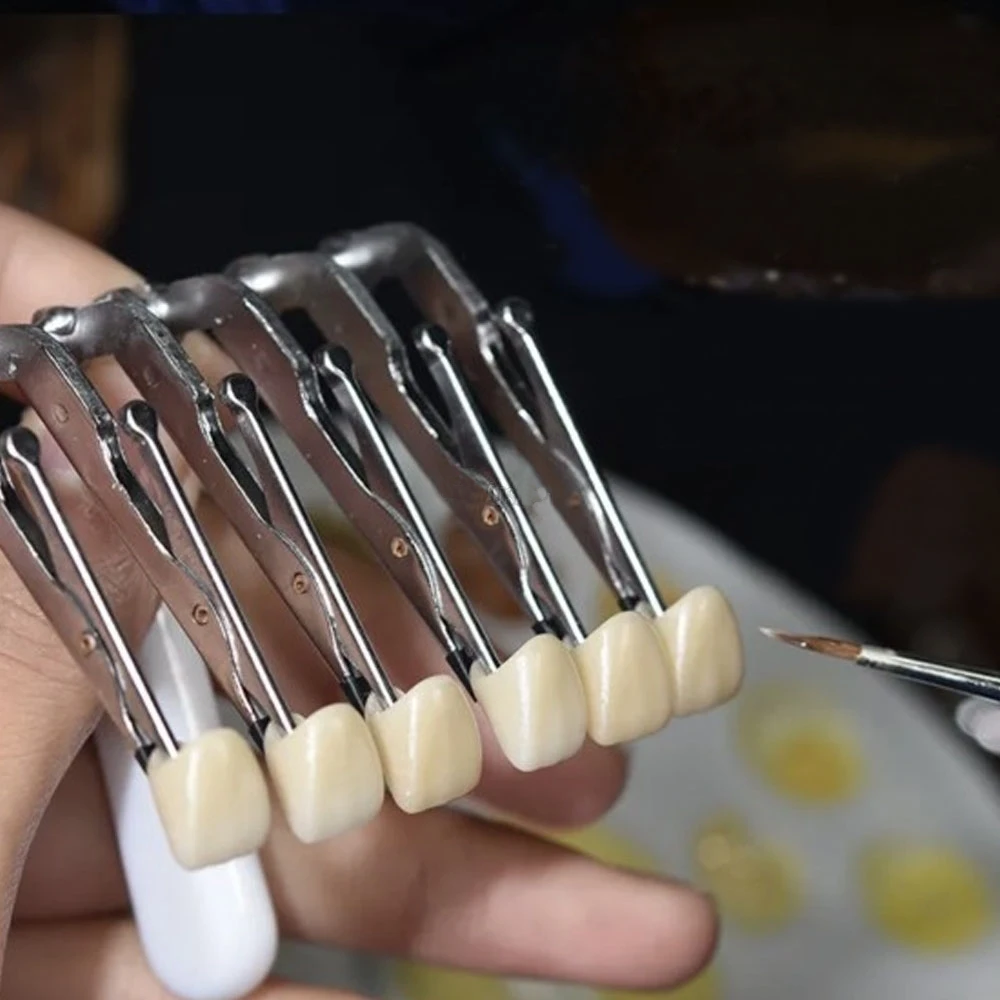 1pc Dental Veneer Porcelain Fa - Teeth Whitening Veneers บทวิจารณ์และราคา