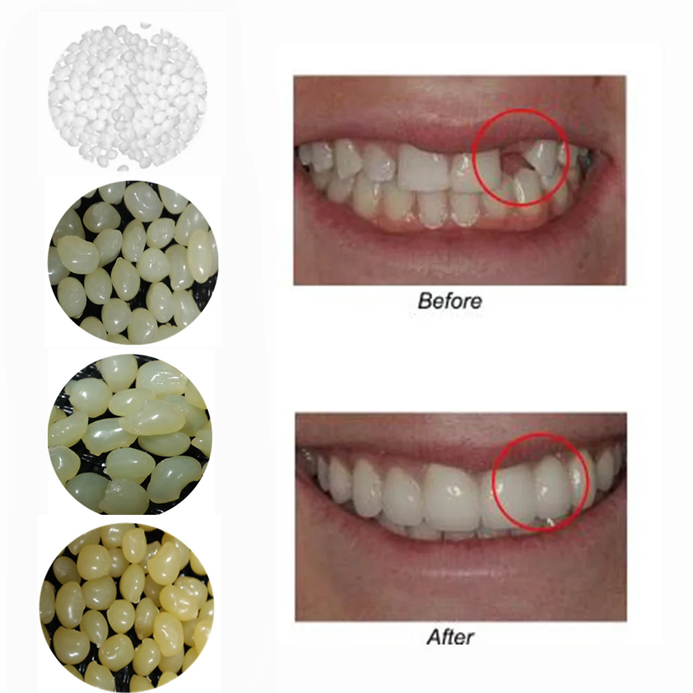 4 Colors Dental Oral False Fak - Teeth Whitening Uv Kit บทวิจารณ์และราคา