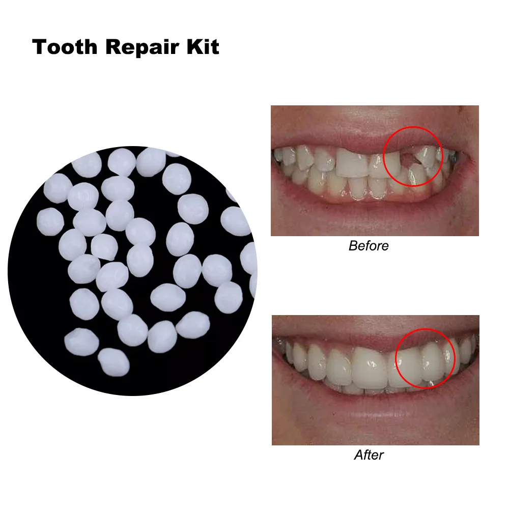 4 Colors Dental Oral False Fak - Teeth Whitening Uv Kit บทวิจารณ์และราคา