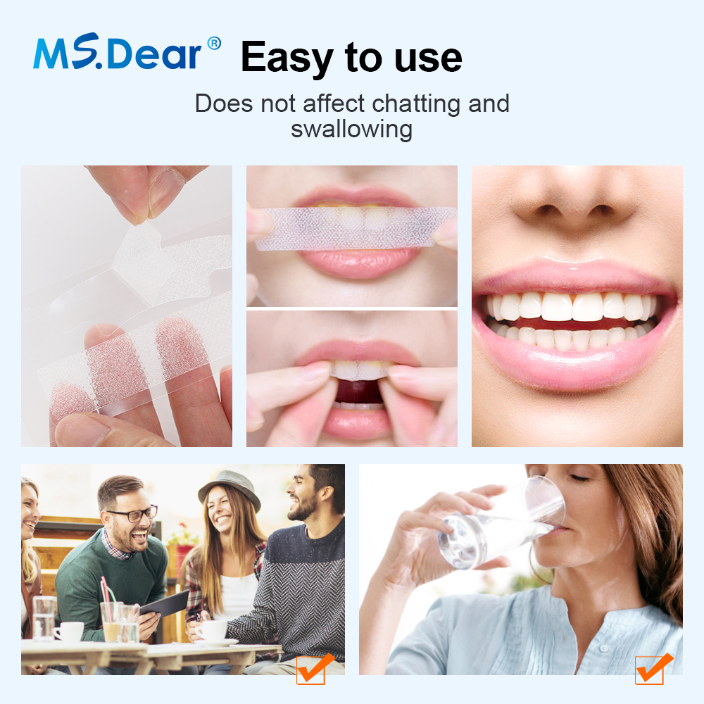 Teeth Whitening Strips Cleansi - Teeth Whitening With Peroxide บทวิจารณ์และราคา